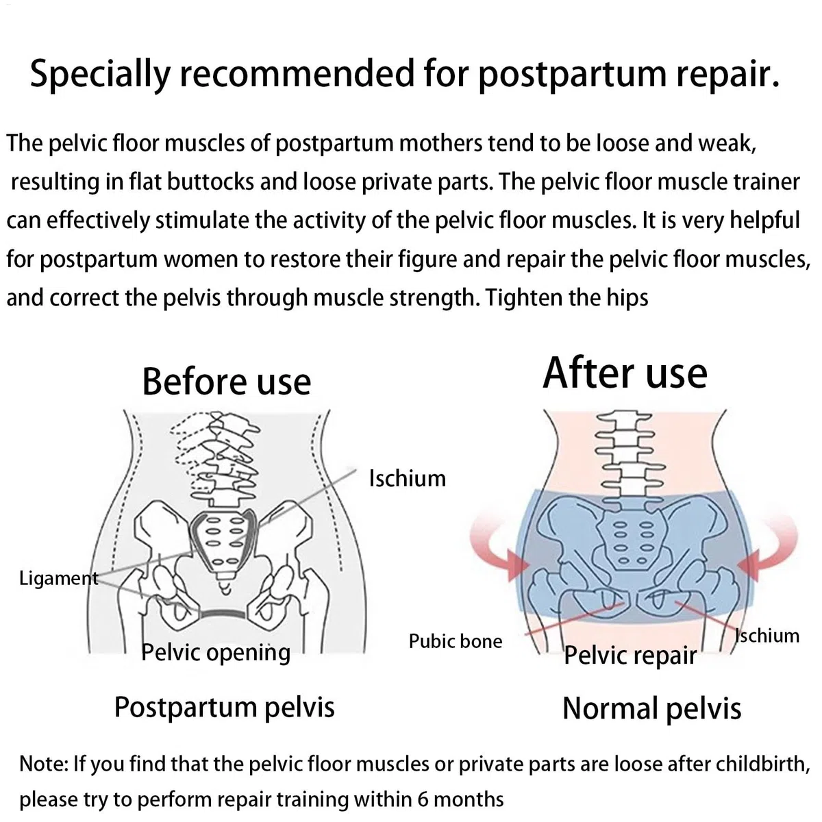 Thigh Master para mujeres,Entrenador de músculos del suelo pélvico,Ejercitador muscular de reparación del suelo pélvico - Entrenamiento de tóner para muslos, dispositivos de ejercicio del suelo pélvic